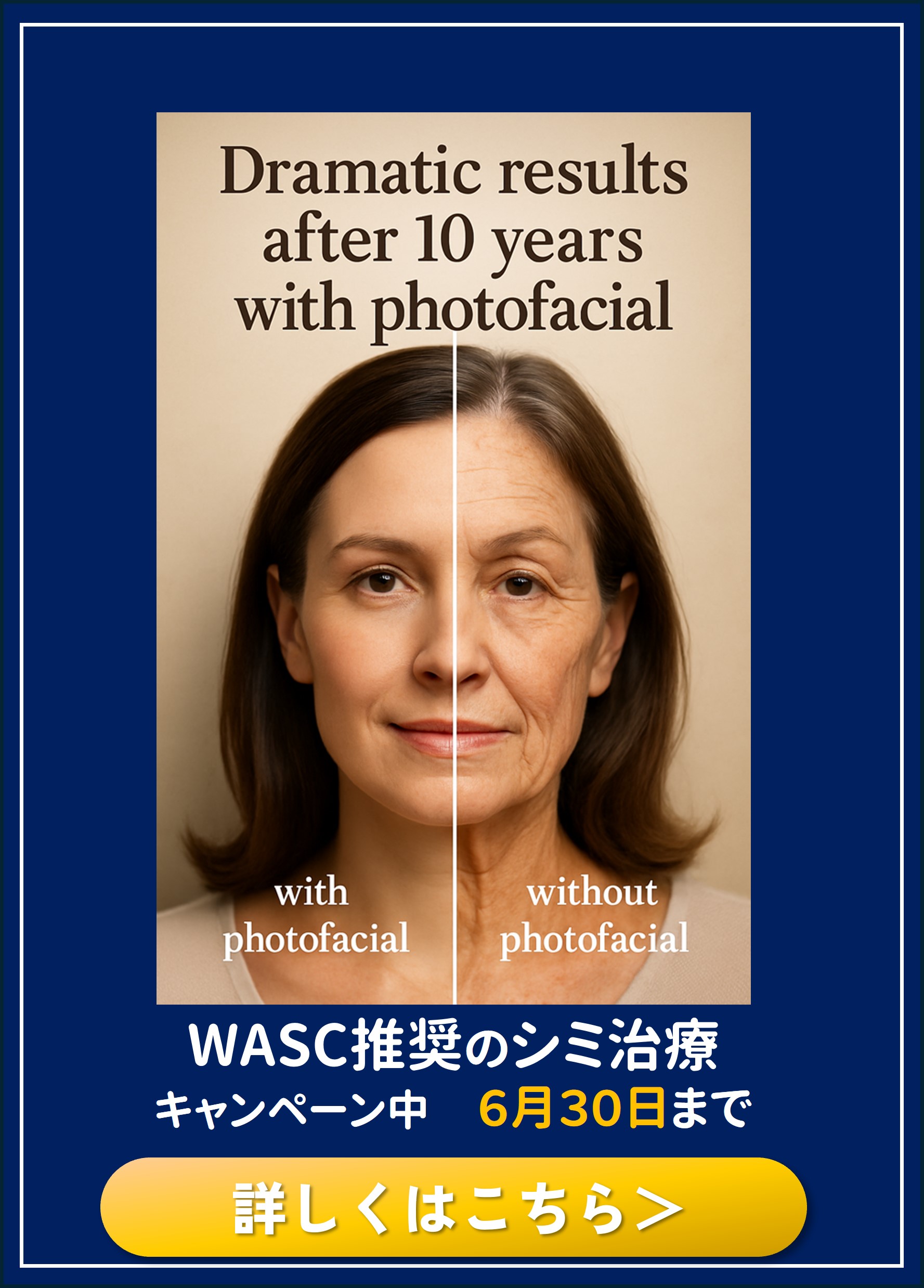 プレオープニングキャンペーンはこちら